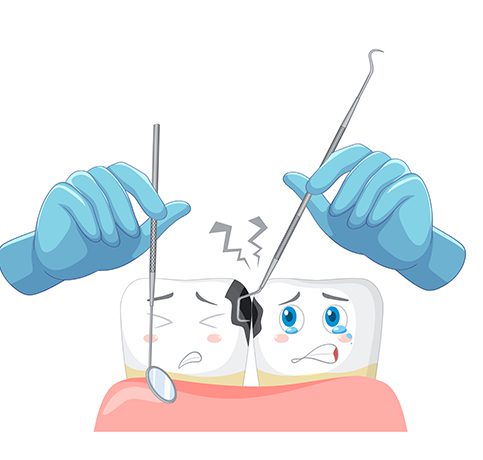 Scaling/Teeth Cleaning