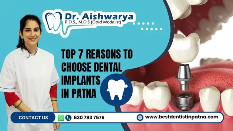 Why You Should Choose Dental Implants in Patna? 7 Reasons