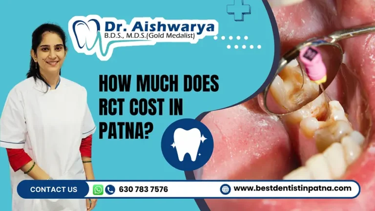 RCT Cost in Patna & 6 Factors to Choose Affordable Services