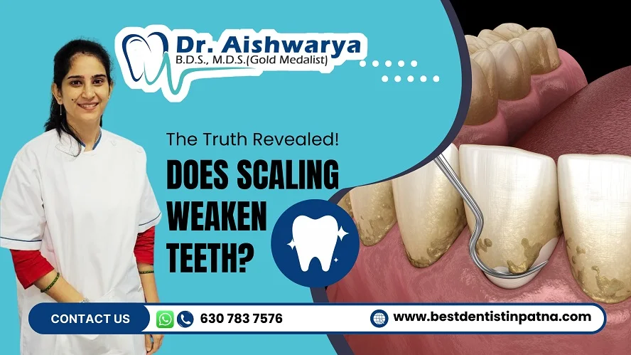 Does Scaling Weaken Teeth