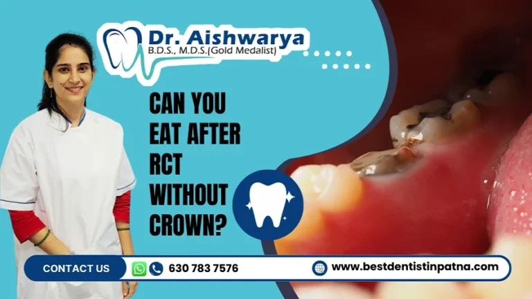 Can You Eat After a Root Canal without Crown? Tips by Dr. Aishwarya