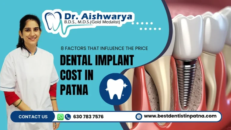 What is the Dental Implant Cost in Patna? 8 Factors Explained