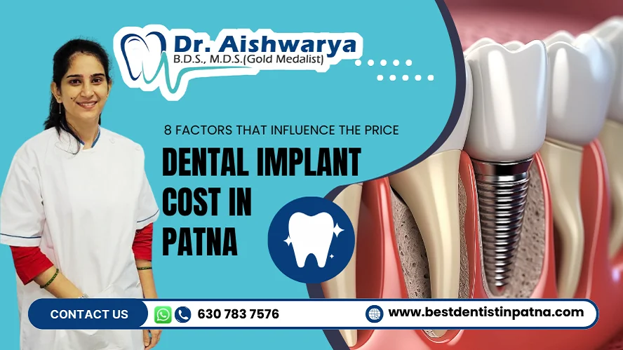 dental implant cost in Patna