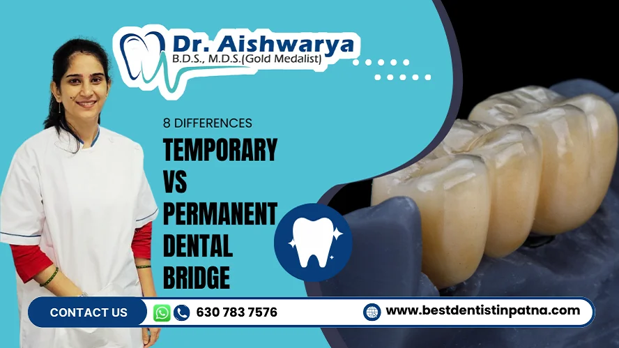 temporary vs permanent dental bridge