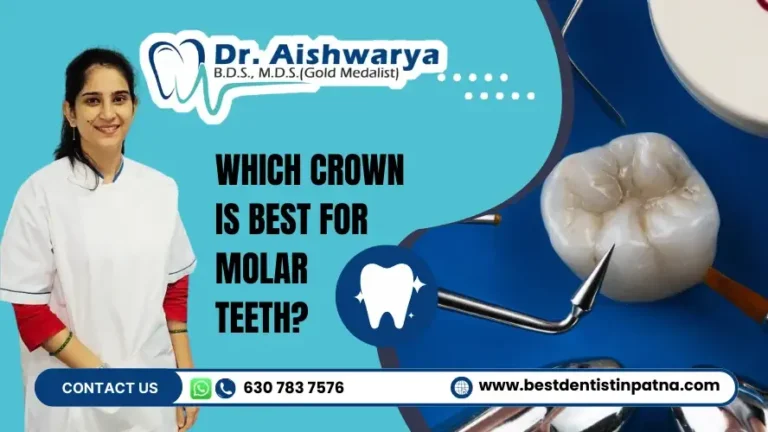 Dental Crown For Molar Teeth – Which is Best? (Recommendations)