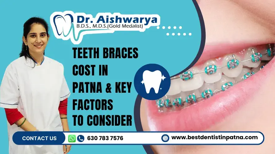 Teeth Braces Cost in Patna