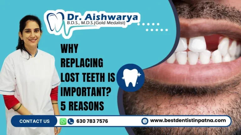 Why Replacing Lost Teeth Is Important? 5 Alarming Reasons