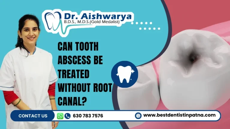 Can Tooth Abscess Be Treated Without Root Canal & Heal On Its Own?