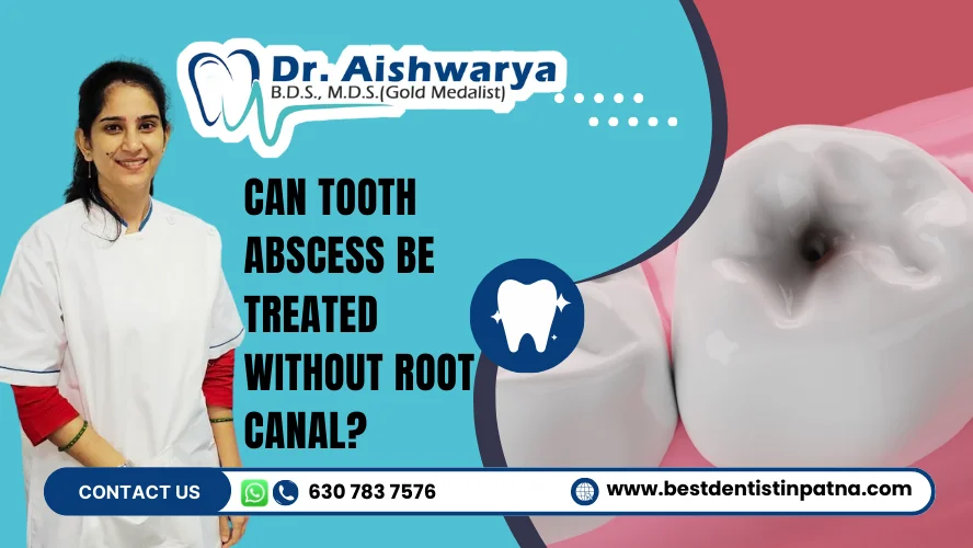 can tooth abscess be treated without root canal