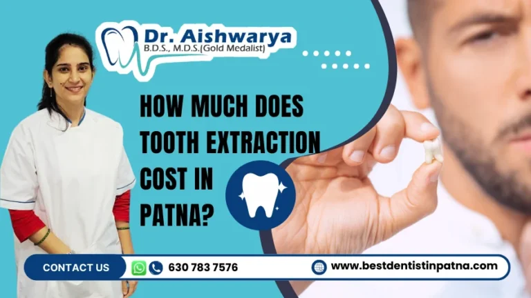 How Much Does Tooth Extraction Cost in Patna? Find Out Here!