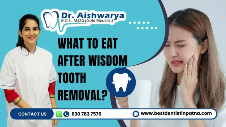 Top 10 Soft Foods for Fast Recovery After Wisdom Tooth Removal