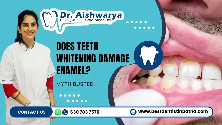 does teeth whitening damage enamel