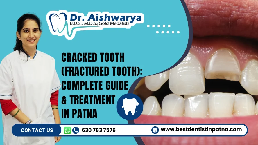 Cracked Tooth