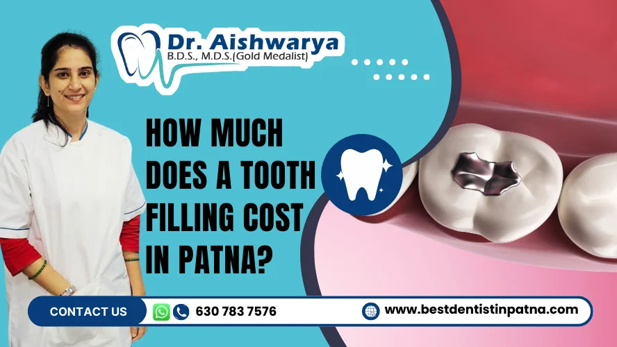 tooth filling in patna