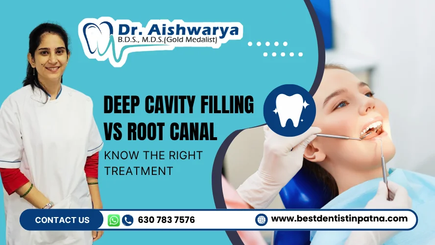 Deep Cavity Filling vs Root Canal