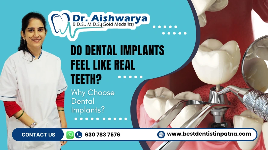 Do Dental Implants Feel Like Real Teeth