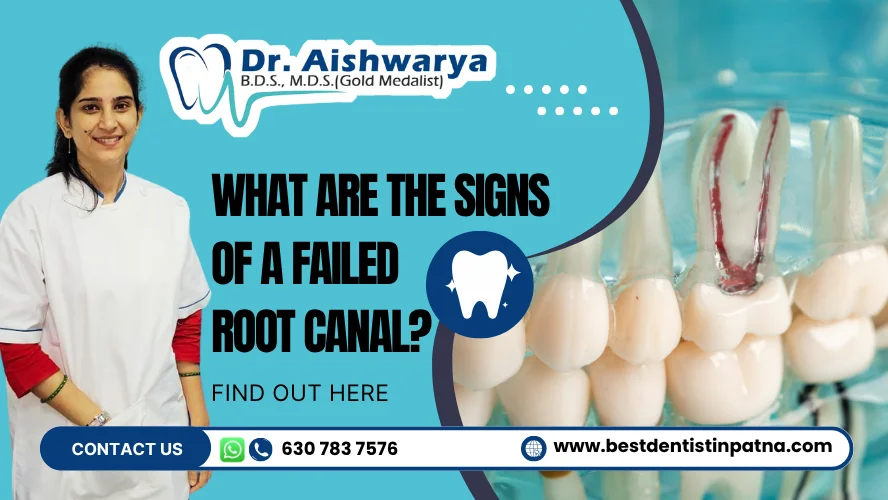 signs of a failed root canal