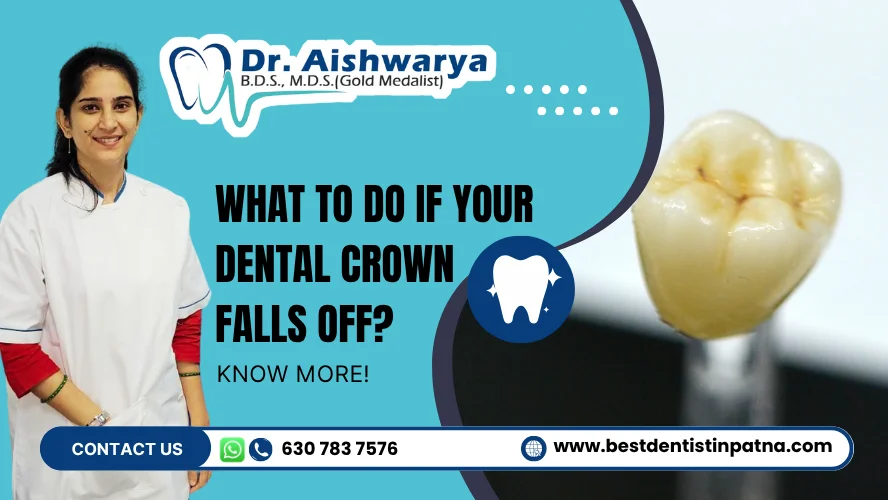 What to Do If Your Dental Crown Falls Off
