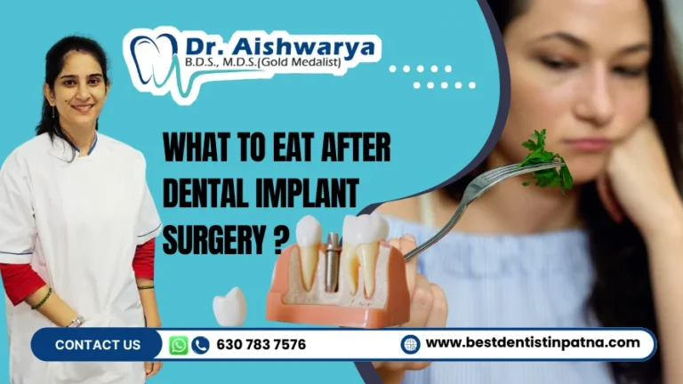 Dental Implant Recovery Diet | Foods to Eat After Surgery