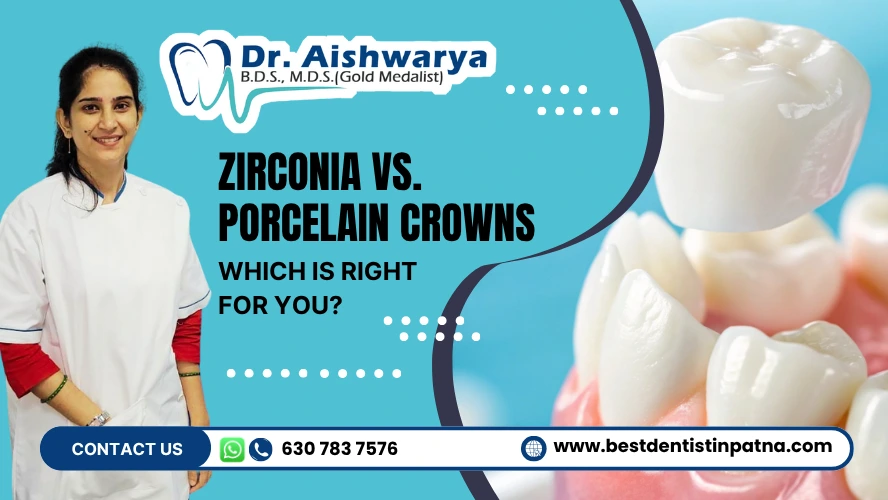 Zirconia vs Porcelain Crowns
