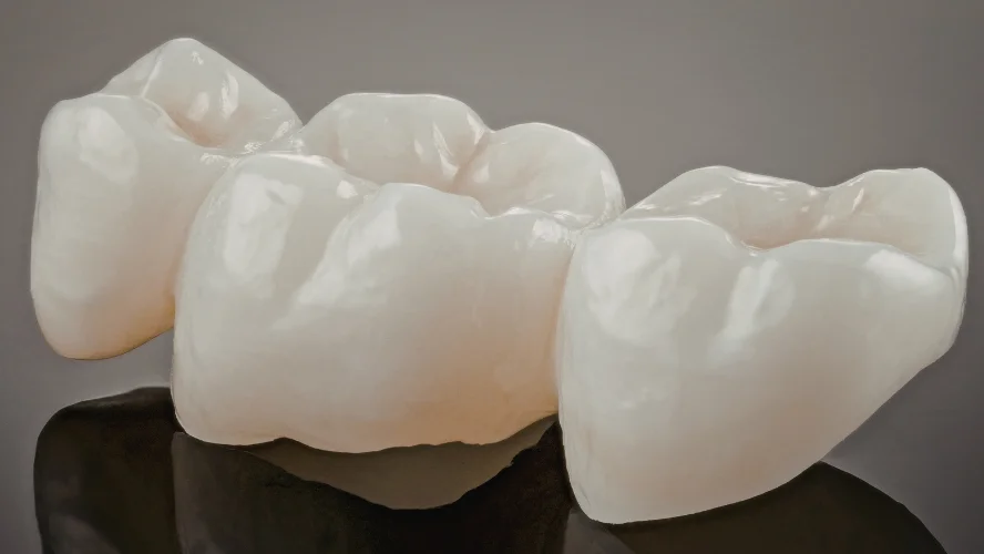 dental crown