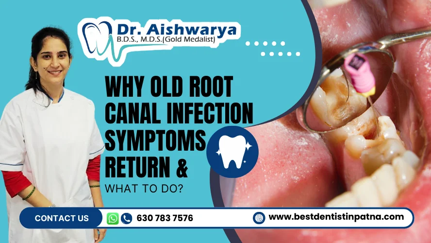 Old Root Canal Infection Symptoms