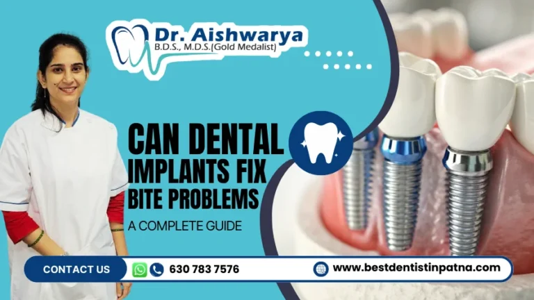 Correcting Bite Problems Using Dental Implants: A Guide