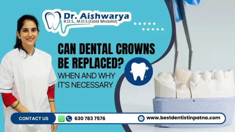 Can Dental Crowns Be Replaced? What You Need to Know