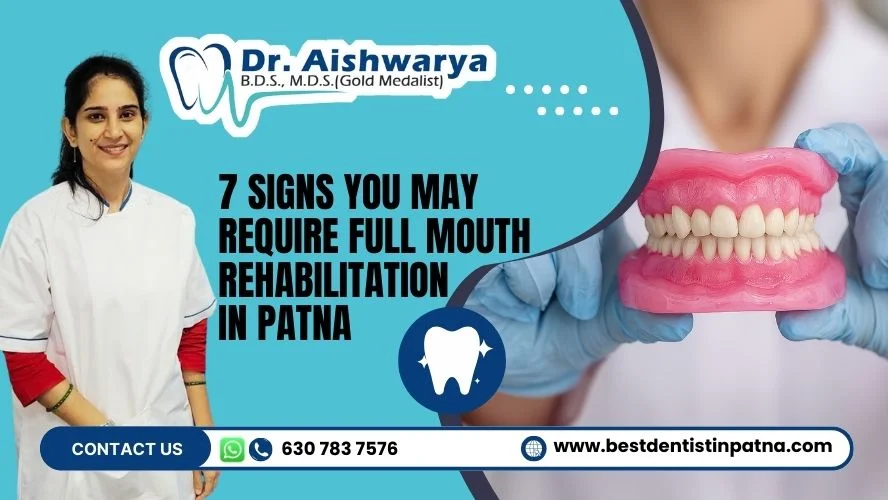 7 Signs You May Require Full Mouth Rehabilitation in Patna