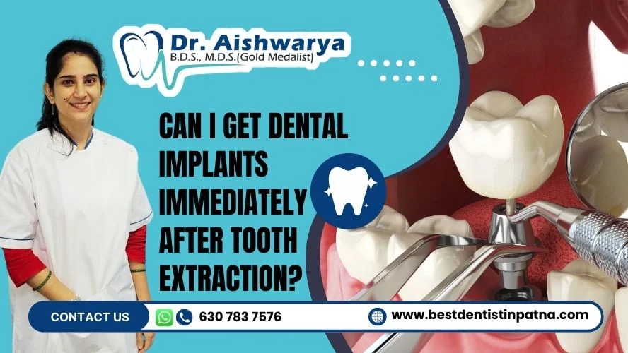 dental implants after tooth extraction