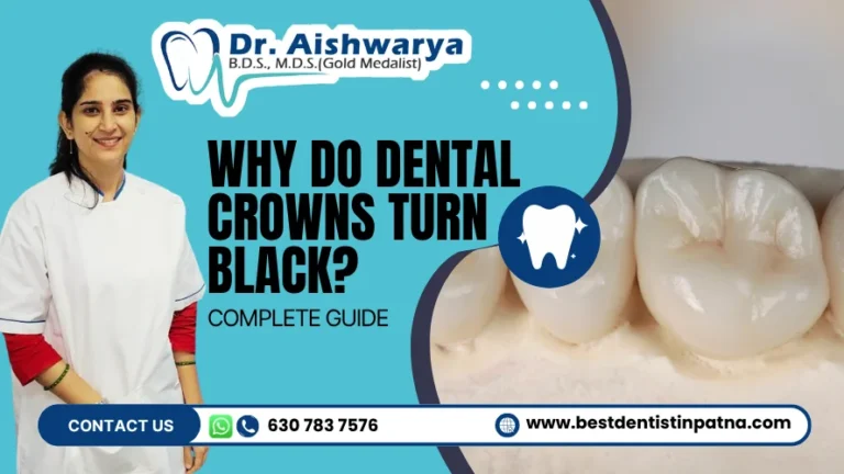 Dental Crown Discoloration: Why It Turns Black & What to Do?