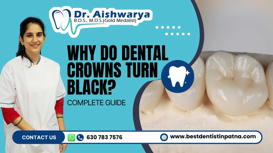 Do Dental Crowns Turn Black