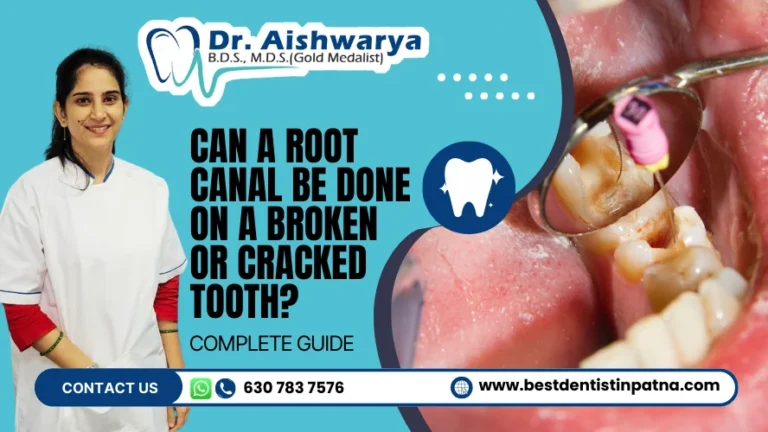 Root Canal for Broken or Cracked Teeth: Is It Possible?