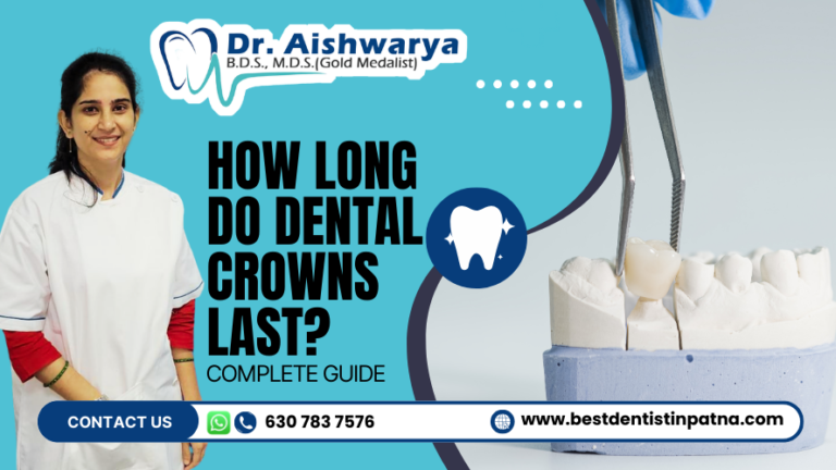 How Long Do Dental Crowns Last? Complete Guide