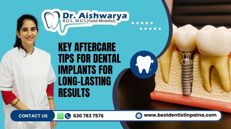Key Aftercare Tips for Dental Implants for Long-Lasting Results