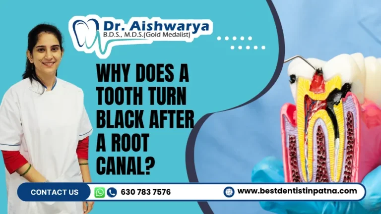 Why Does a Tooth Turn Black After a Root Canal?