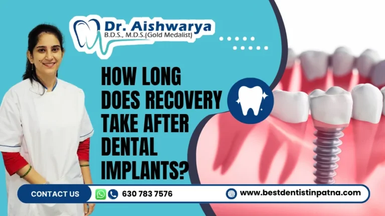 How Long Does Recovery Take After Dental Implants? | Complete Guide