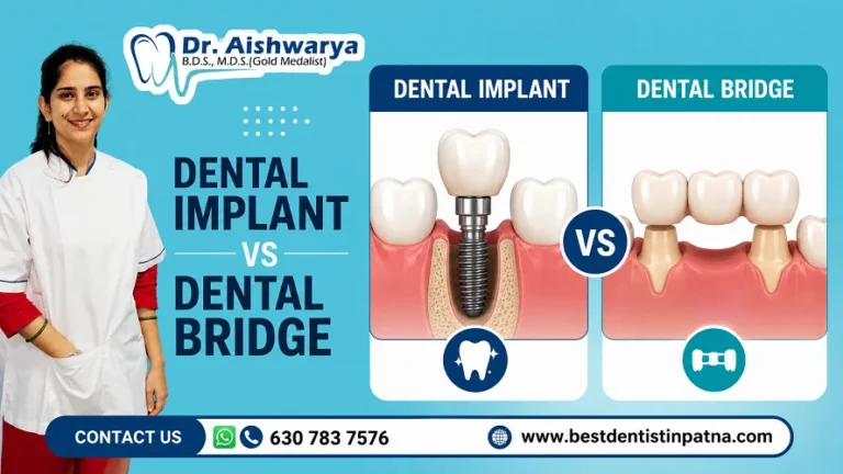 Dental Implant vs Dental Bridge: Which Is Better?