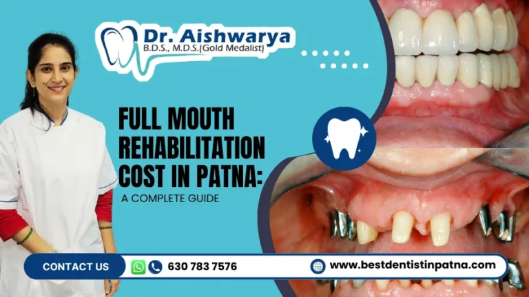 Full Mouth Rehabilitation Cost in Patna: Factors, Treatment Options & What to Expect