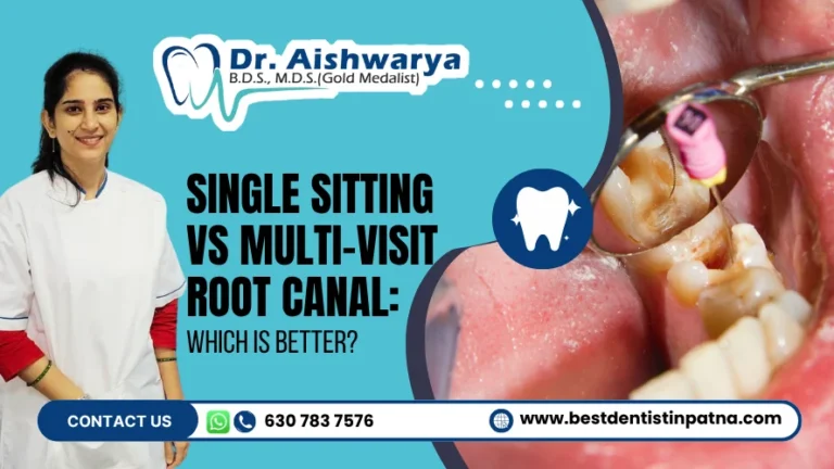 Single Sitting vs Multi-Visit Root Canal: Which Is Better?