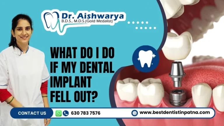 What Do I Do If My Dental Implant Fell Out? Find Out!