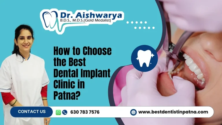 Best Dental Implant Clinic in Patna | Dr. Aishwarya Dental