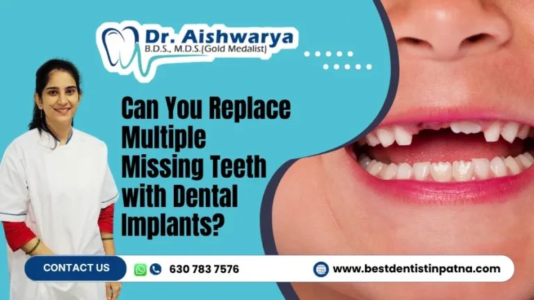 Can Dental Implants Replace Multiple Missing Teeth?
