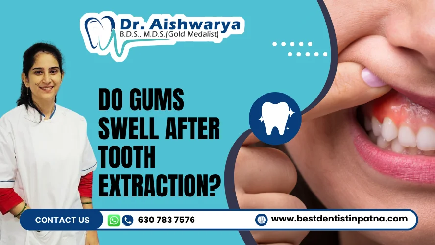 Swollen Gums After Tooth Extraction