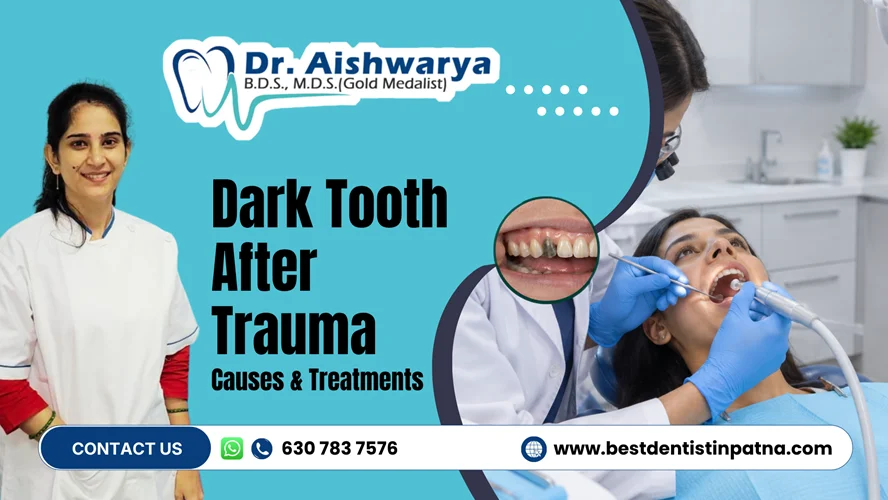 Why Does a Tooth Darken After Trauma and How It’s Treated?