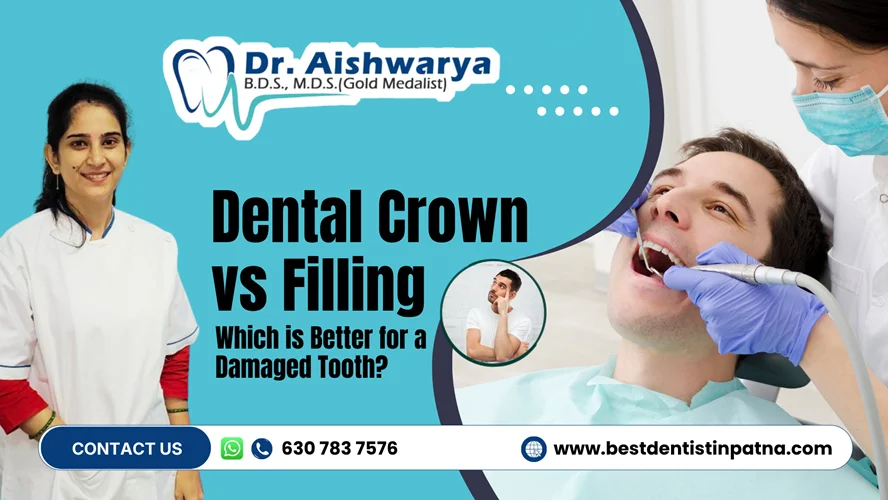Dental Crown vs Filling