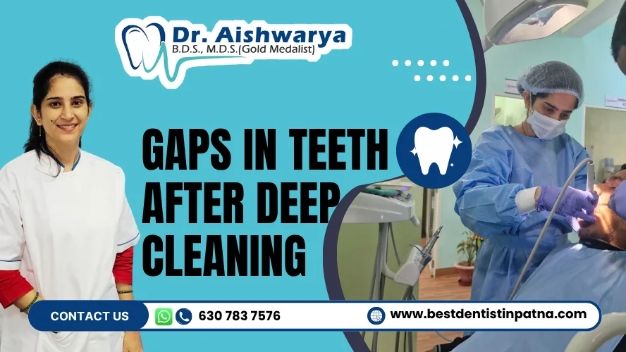 Why Are There Gaps in Teeth After Deep Cleaning?