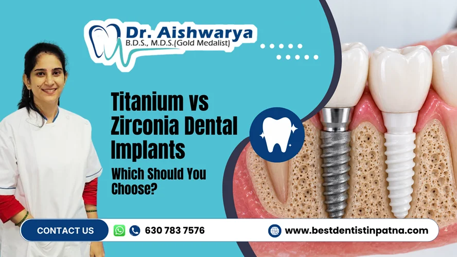 Titanium vs Zirconia Dental Implants: Which Should You Choose?