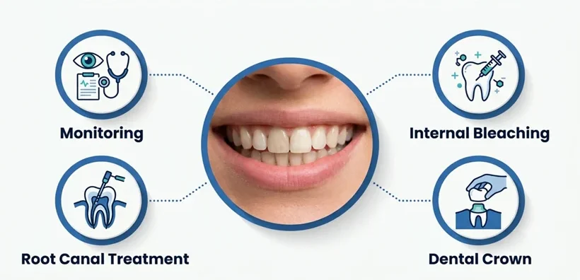 Treatment for Dark Tooth After Trauma in Patna