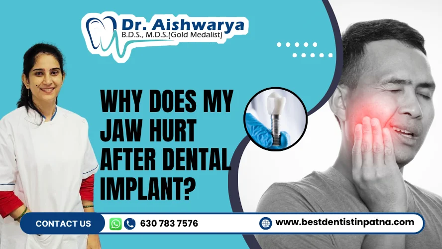 Why Does My Jaw Hurt After Dental Implant Treatment?